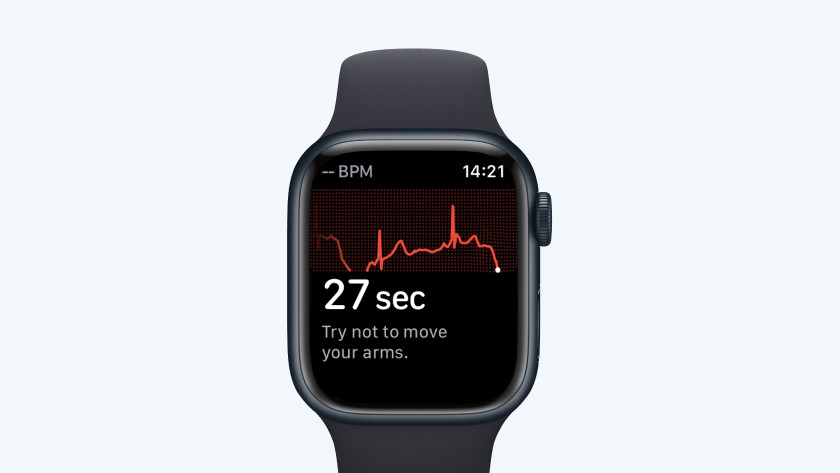 Apple watch best sale se irregular heartbeat