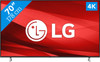 LG 70UP77006LB