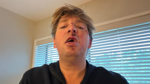 Bike helmets Hersenstichting