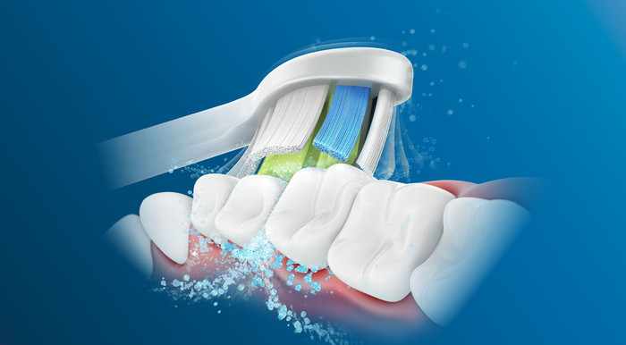 Philips Sonicare W2 Optimal White HX6068/12 product in gebruik