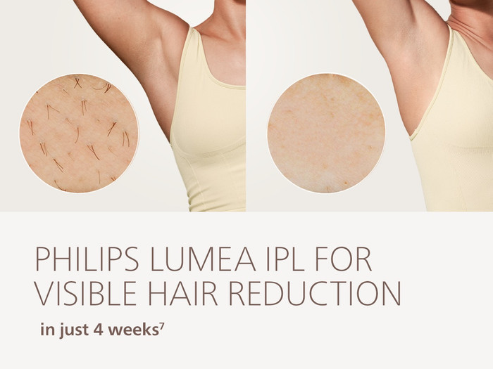 Philips Lumea IPL 7000 Series BRI930/00 visual leverancier