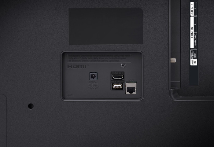 LG 75UR78006LK (2024) detail