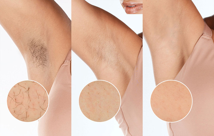 Philips Lumea IPL 9900 Series BRI953/02 visual supplier