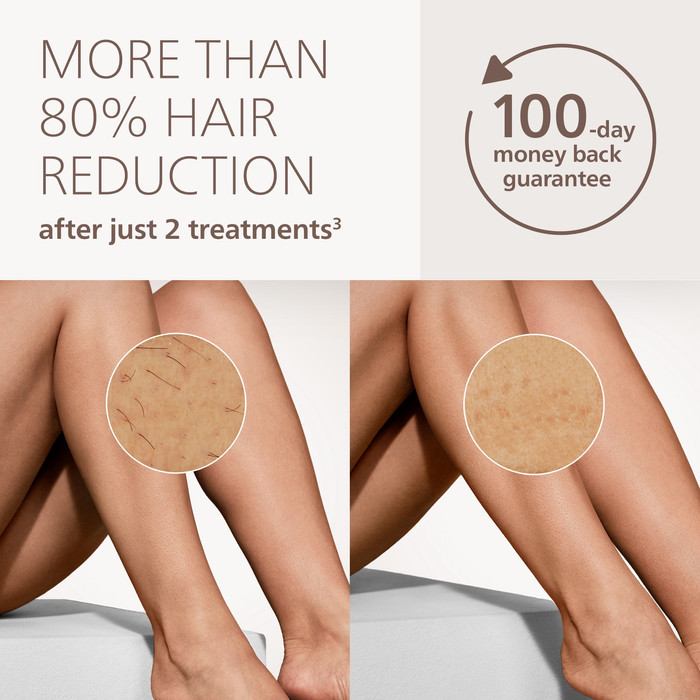 Philips Lumea IPL 9900 Pro Series BRC342/00 visual leverancier