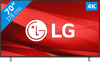 LG 70UP77006LB