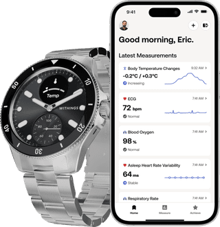 Withings Scanwatch Nova Zwart